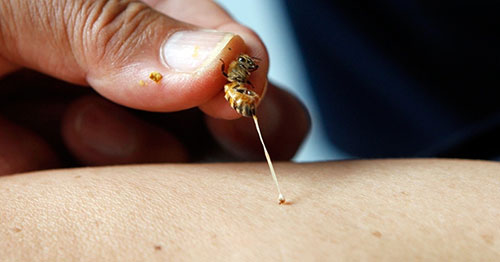 Вред и польза лечения пчелами 